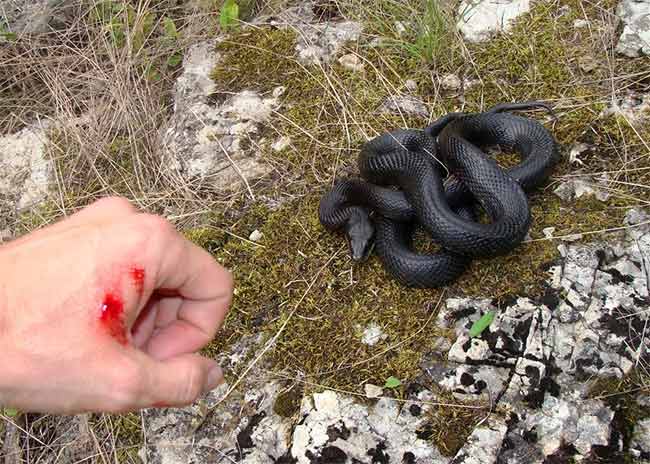 Dreaming of being Bitten by A Snake