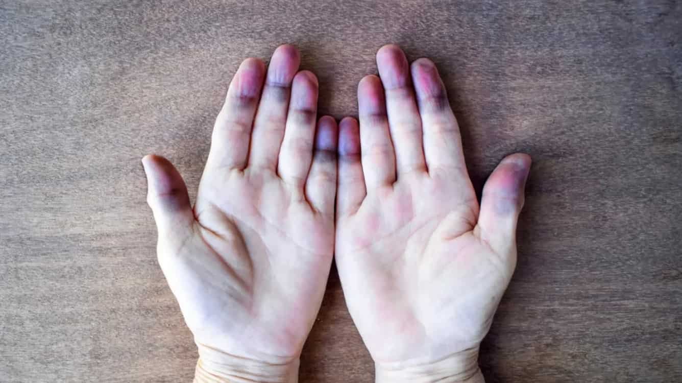 Spiritual Meanings of Cold Hands