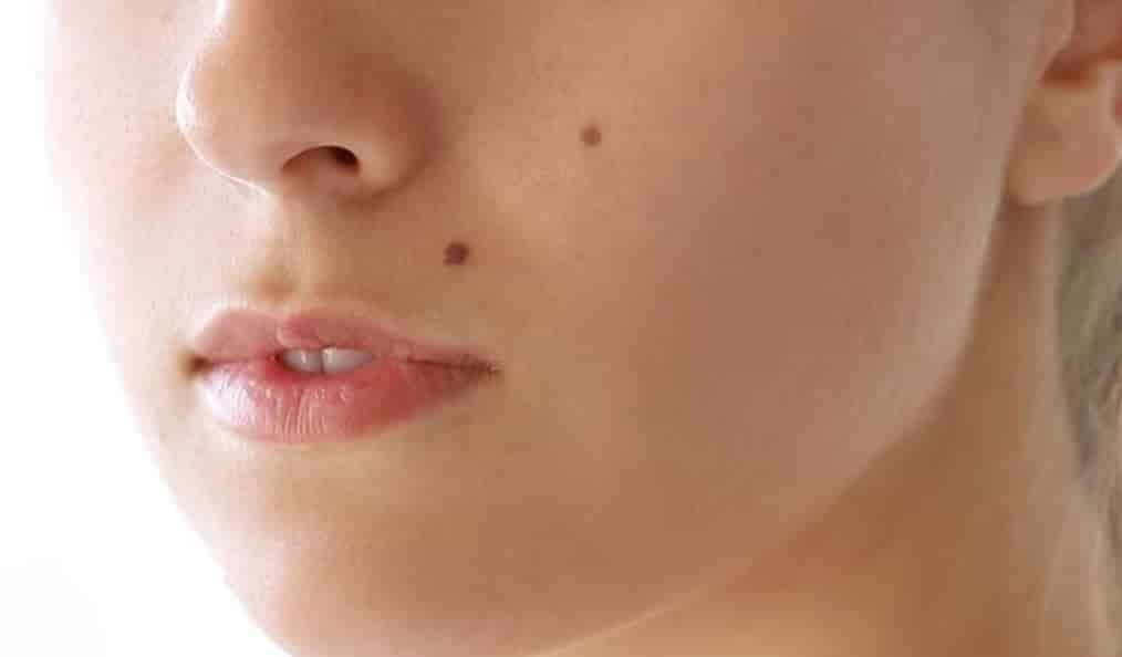 Spiritual Meanings of Moles on the Face