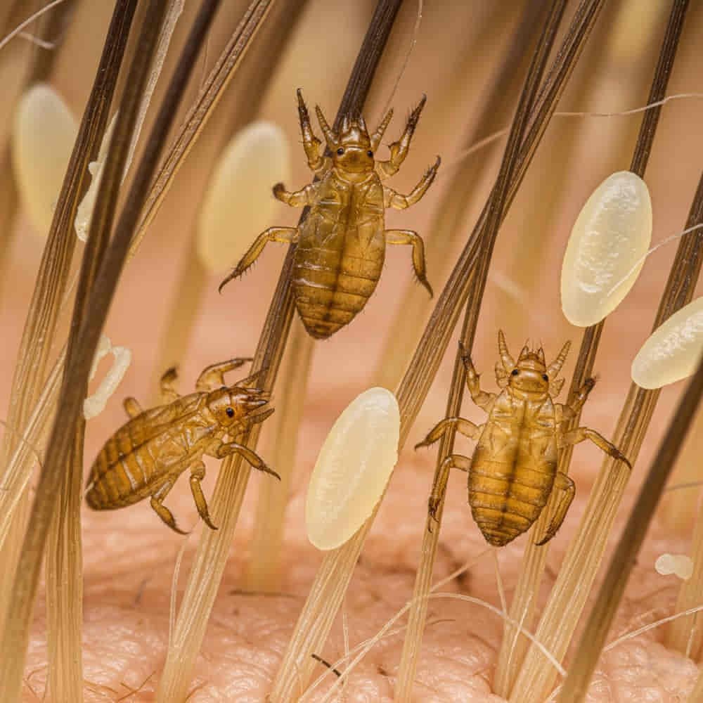 Spiritual Meanings of Lice