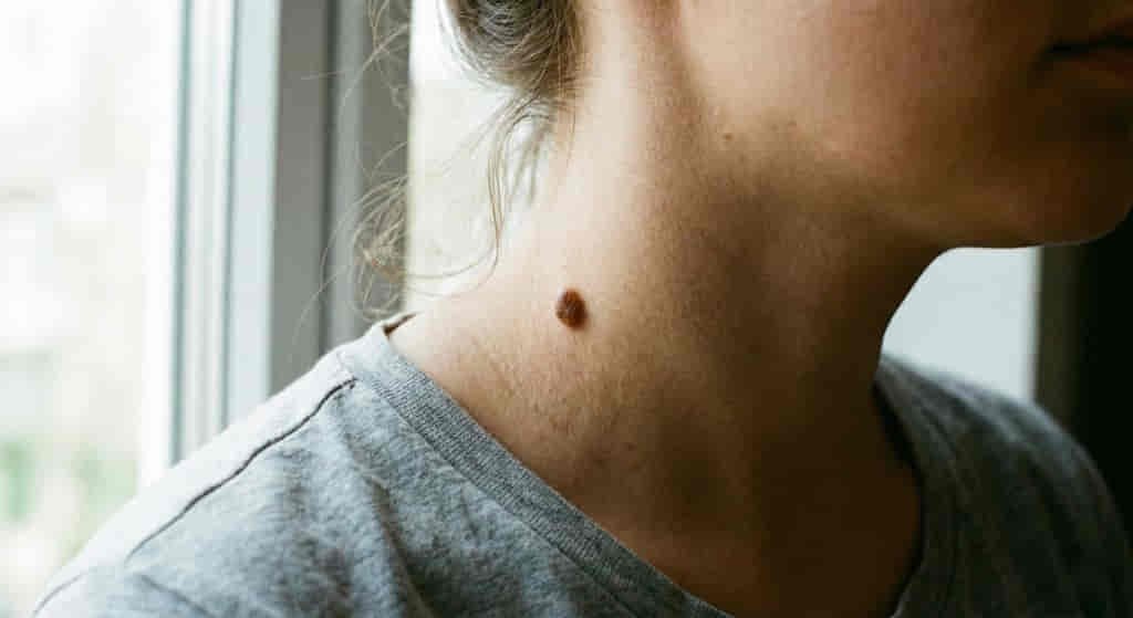 Spiritual Meanings of Moles on the Neck