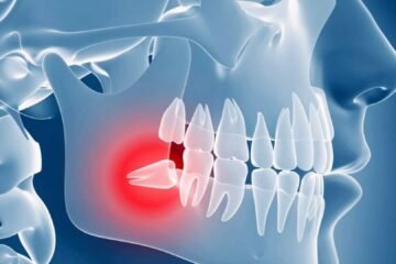 5 Wisdom Teeth Spiritual Meanings You Should Know