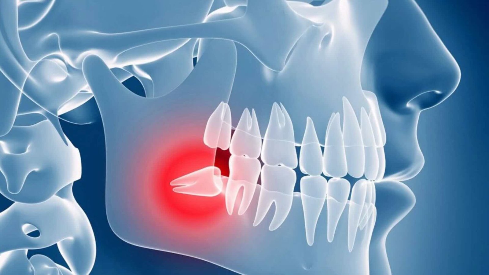 Wisdom Teeth Spiritual Meaning